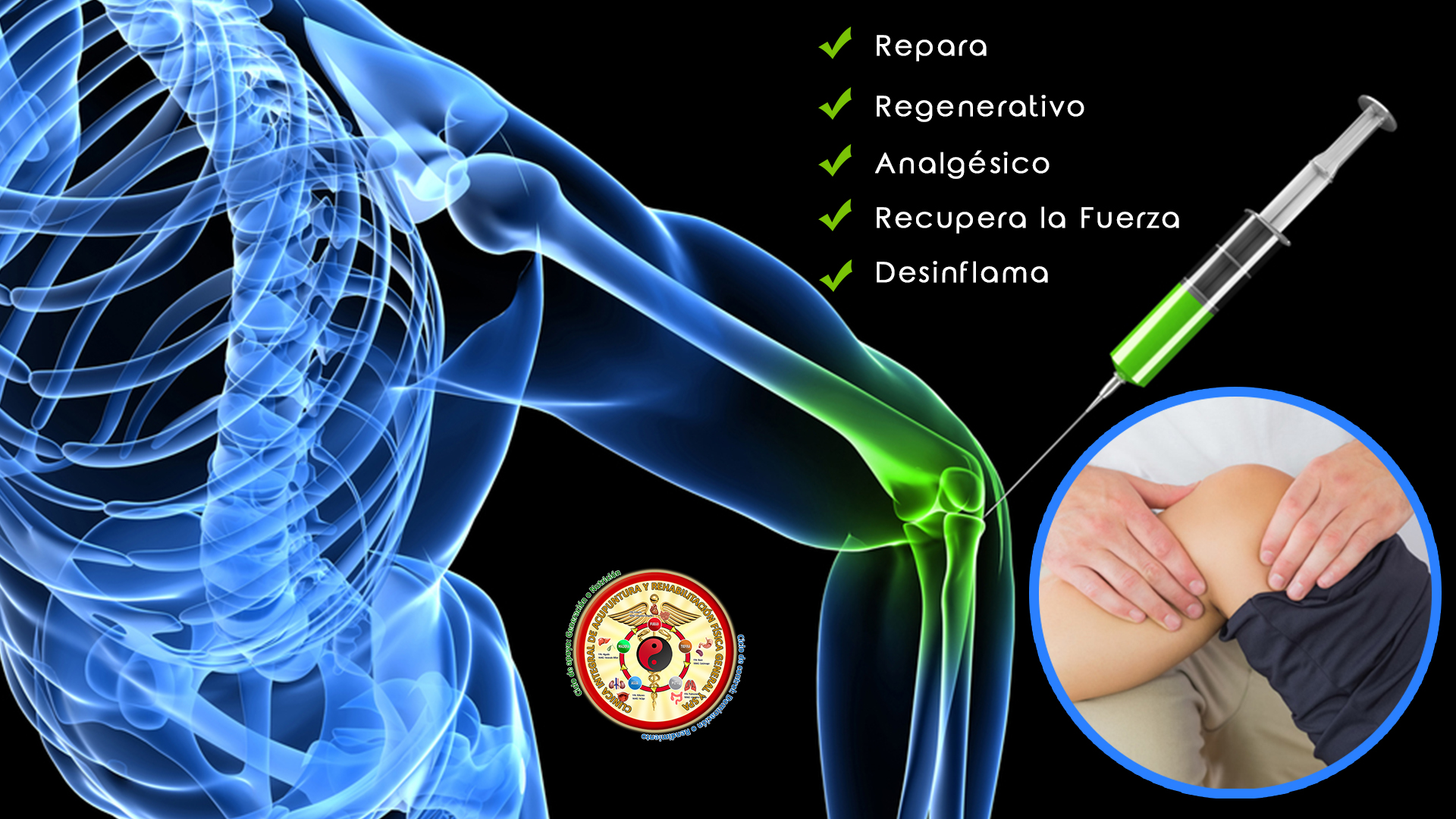 Proloterapia Artrosis
